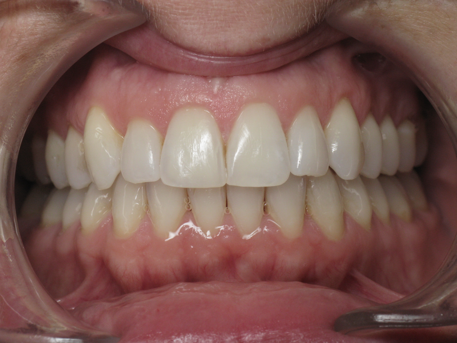 Orthodontic Treatment Case Study