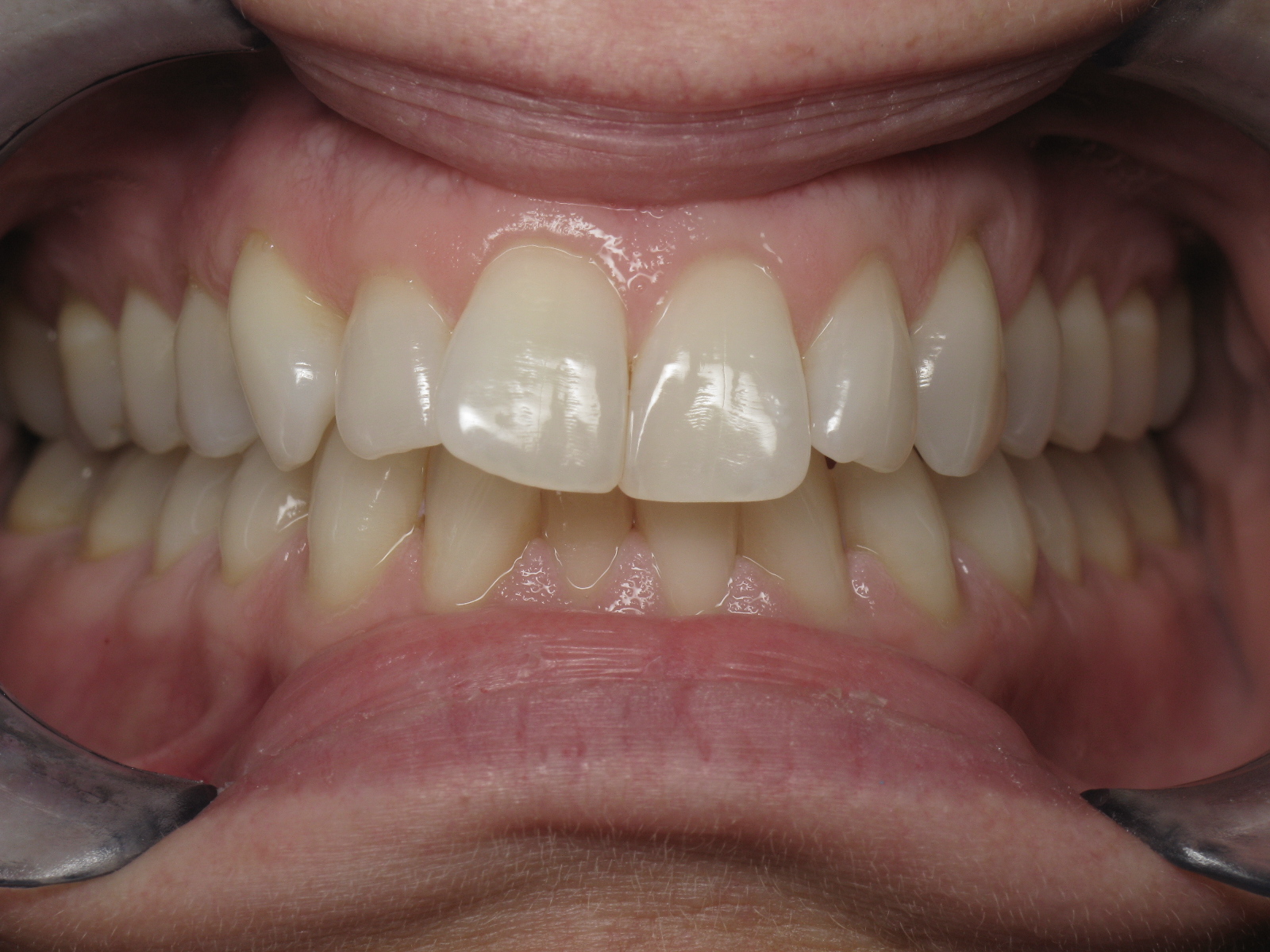 Orthodontic Treatment Case Study